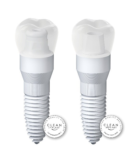 Close-up of a ceramic zirconium dental implant restoration at LiderDent Zagreb